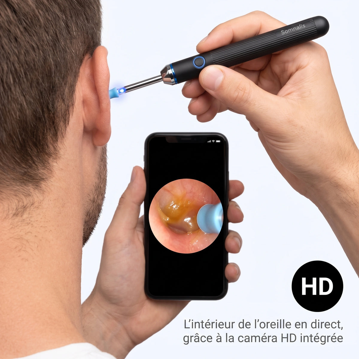 Somnalis™ — Nettoyage des oreilles précis avec caméra HD